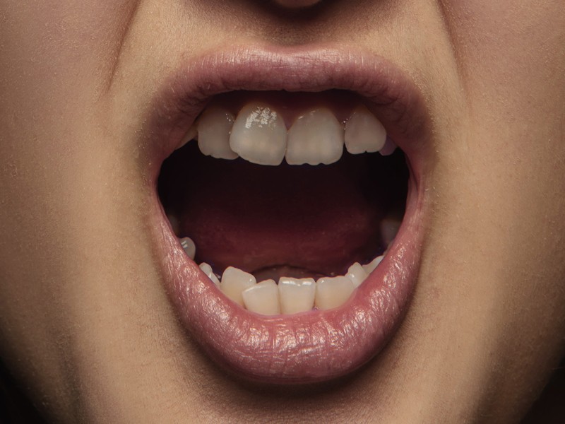 10大咬合不正可能引發的併發症!! 常常講話漏風、肩頸痛、頭痛、沒自信、消化不良嗎?